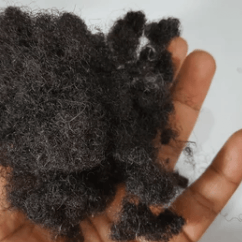 Black Women And Hair Loss – How Common Is It And Why Is It Happening?